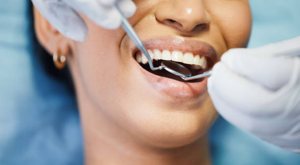 Best Emergency Root Canal Treatment in Jacksonville, OR